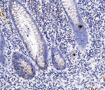 Anti-Peptide YY/PYY Antibody