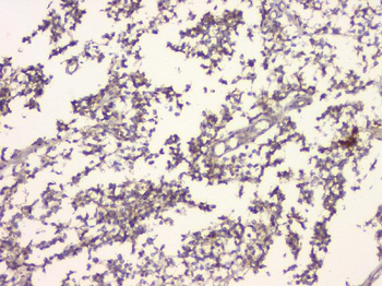 Anti-APP/C99 Antibody