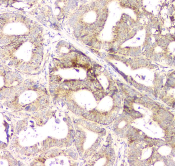Anti-Aprt Antibody