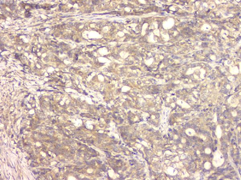 Anti-BMP15 Antibody