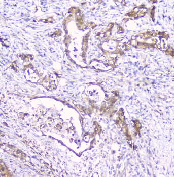 Anti-CDA Antibody