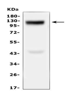 Collagen XVII/COL17A1 Antibody