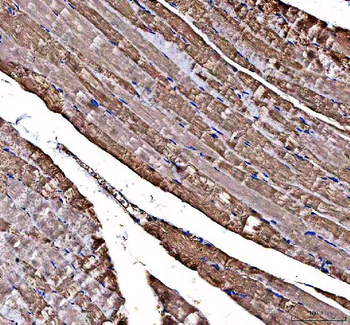 Anti-DOK7 Antibody