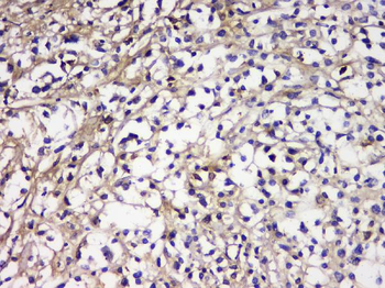 Anti-IGLL1 Antibody