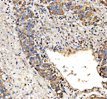Anti-IL34 Antibody