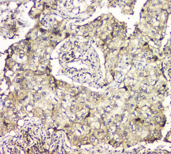 Anti-MCUR1 Antibody