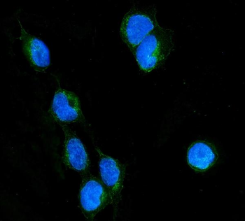 Anti-RHOB Antibody