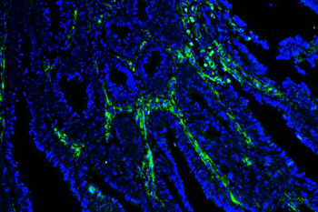 Anti-Caveolin-1/CAV1 Antibody (monoclonal, 12C7)