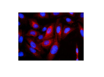 Anti-Cytokeratin 8 KRT8 Antibody (monoclonal, 3G9)