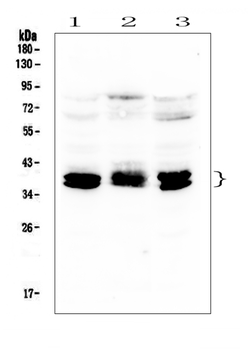 Anti-CXCR4 Antibody