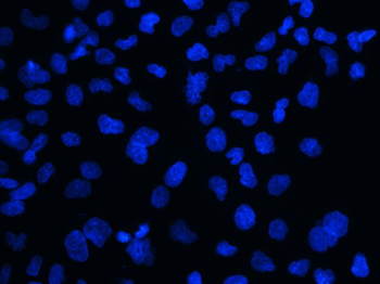 Anti-MECP2 Antibody