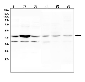 Anti-CCR2 Antibody