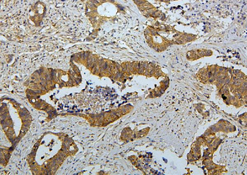 Anti-RET Antibody