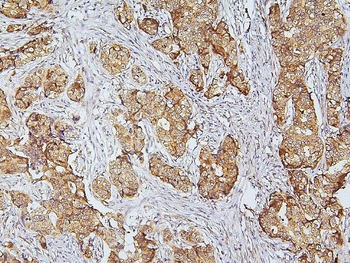 Anti-CDK5 Antibody