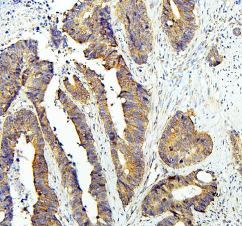 Anti-Zinc finger protein GLI2 GLI2 Antibody