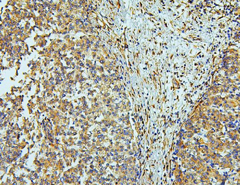 Anti-WNT4 Antibody