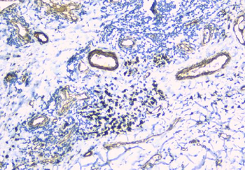 Anti-TIE2/TEK Antibody