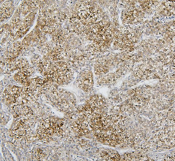 Anti-Cytochrome p450 2C19/CYP2C19 Antibody
