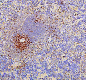 Anti-CD8 alpha/Cd8a Antibody