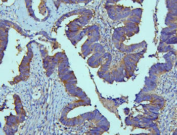 Anti-EBP50/NHERF-1/SLC9A3R1 Antibody