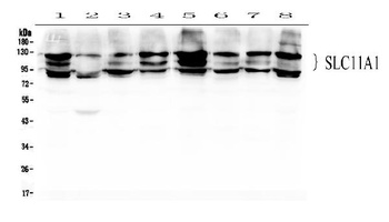NRAMP1/SLC11A1 Antibody