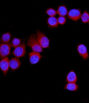 Anti-NRAMP1/SLC11A1 Antibody