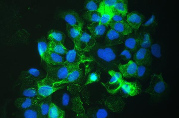 SLC34A2 Antibody