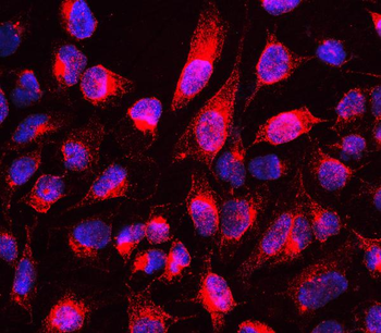 MTUS1 Antibody