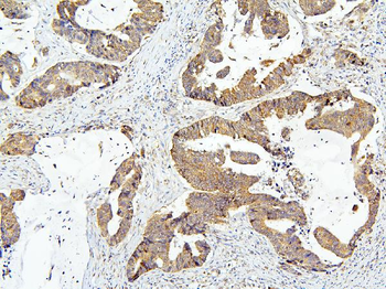 Anti-OLFM4 Antibody