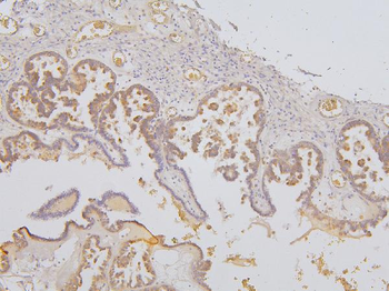 Anti-KCC2/SLC12A5 Antibody