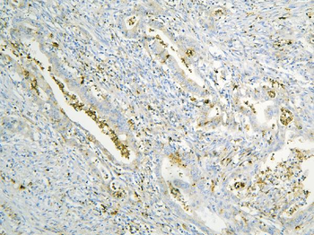 Anti-Annexin A3/ANXA3 Antibody