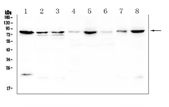 Anti-POMT2 Antibody