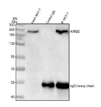 Anti-ARID2 Antibody