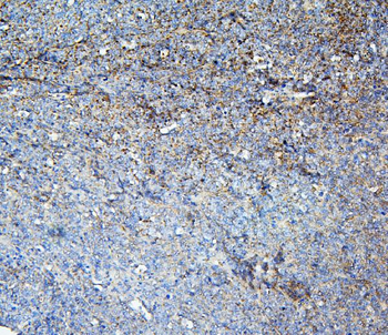 Anti-Loricrin/LOR Antibody