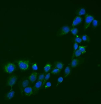 Anti-Semaphorin 3B/SEMA3B Antibody