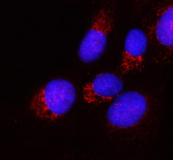 Anti-PPA2 Antibody