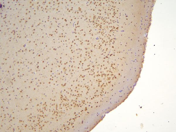 Anti-TAF12 Antibody