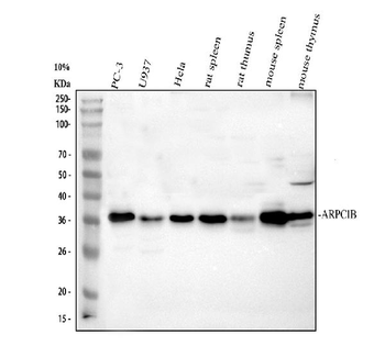 Anti-ARP2/3 subunit 1B/ARPC1B Antibody