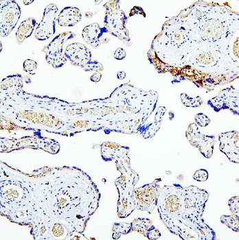 Anti-MUC20 Antibody