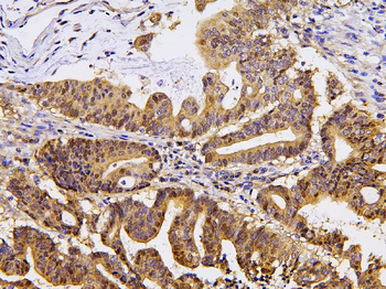 Anti-Pyrophosphatase 1/PPA1 Antibody