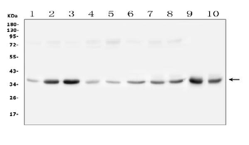 Anti-GPD1L Antibody