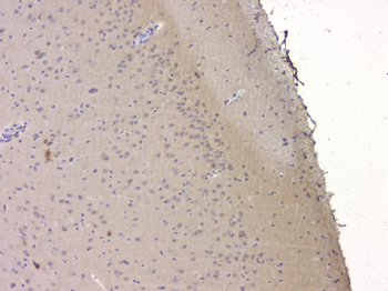 Anti-SRCIN1 Antibody