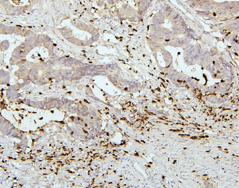 Anti-PEF1 Antibody