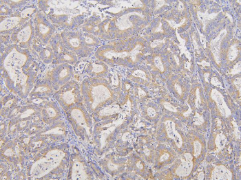 Anti-RNF123 Antibody