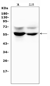 GLUT6/SLC2A6 Antibody