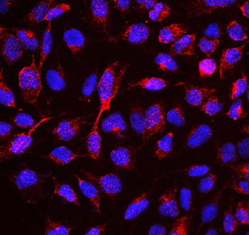 RBMS3 Antibody