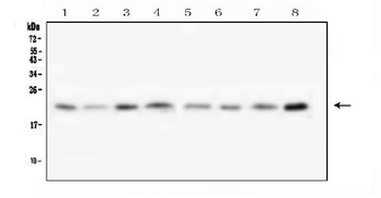 Anti-Transmembrane protein 199 TMEM199 Antibody