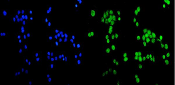 Anti-CCDC36 Antibody