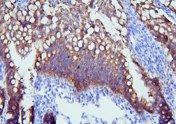 Anti-PYROXD1 Antibody