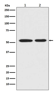 Mutant p53 Rabbit Monoclonal Antibody